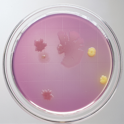 BBL Agar Plates